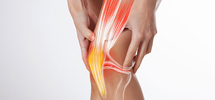 patient needing ligamentitis treatment in Cupertino