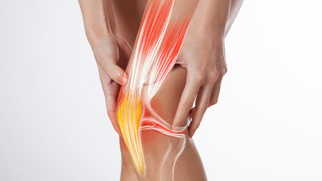 patient requiring ligamentitis treatment in Cupertino