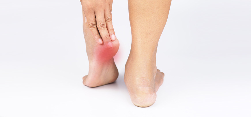 patient needing plantar fasciitis treatment in Cupertino
