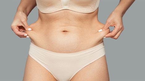 patient requiring skin tightening treatment in Cupertino