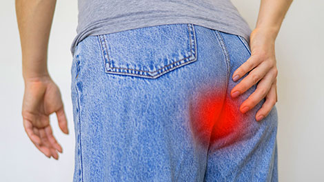 patient requiring tailbone pain treatment in Cupertino