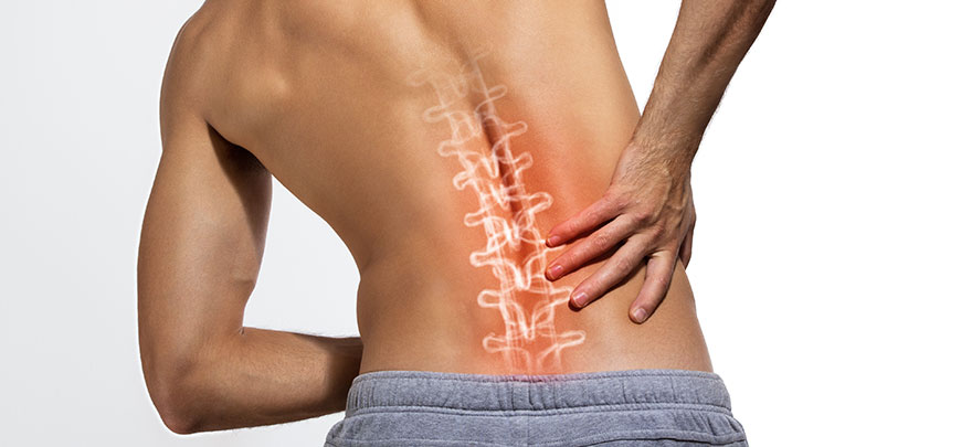 patient needing vertebral subluxation treatment in Cupertino
