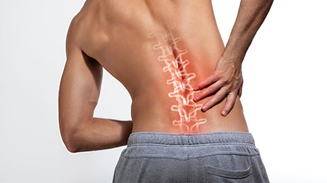 patient requiring vertebral subluxation treatment in Cupertino